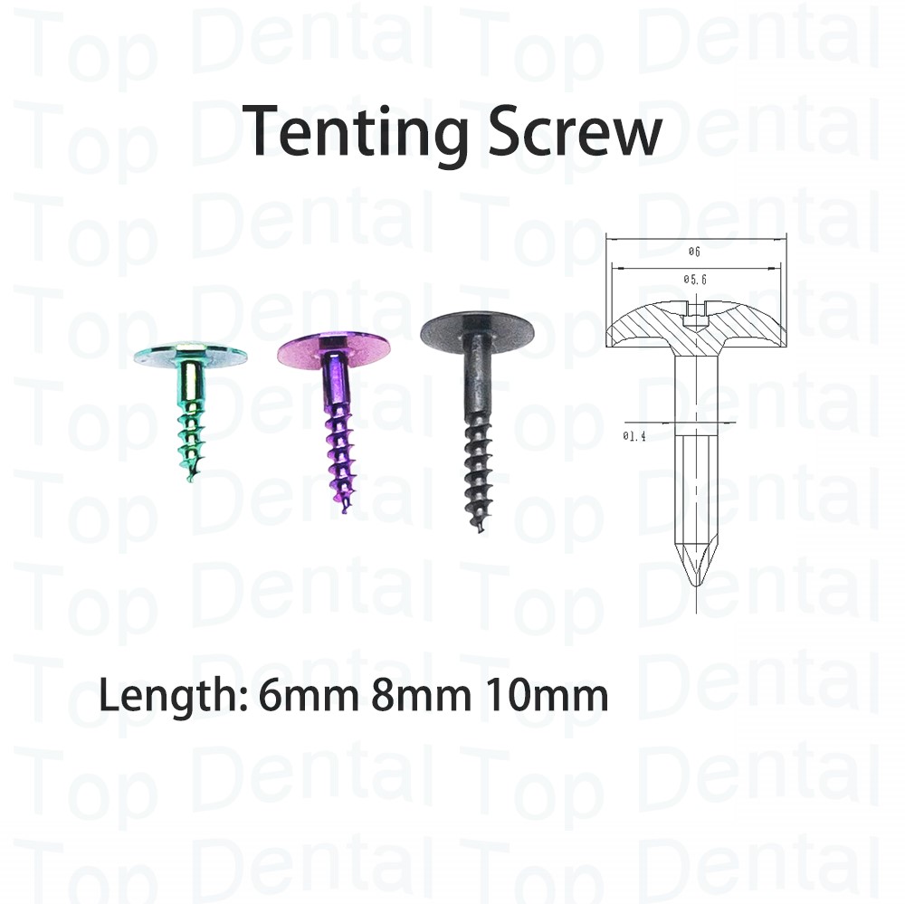 10pcs Dental GBR System Bone S - đánh giá và giá Stabilizer Screw In