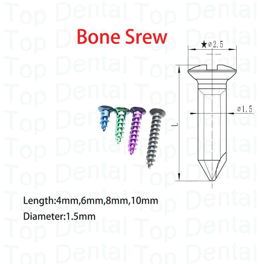 10pcs Dental GBR System Bone S - đánh giá và giá Stabilizer Screw In